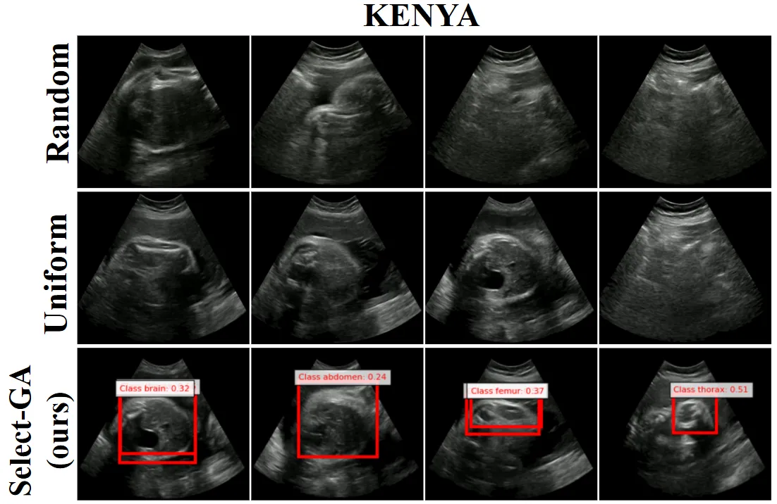 Adaptive fetal ultrasound frame selection examples