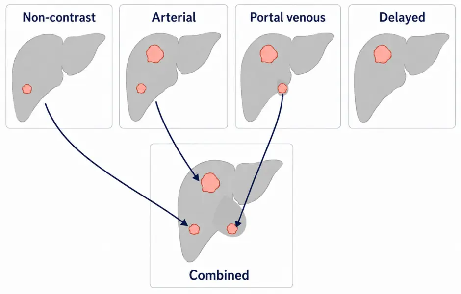 TriALS four-phase lesion supervision teaser